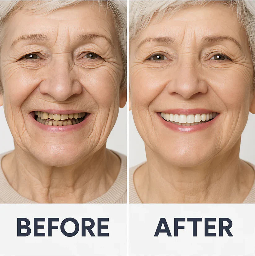 Custom-SET Functional Dentures