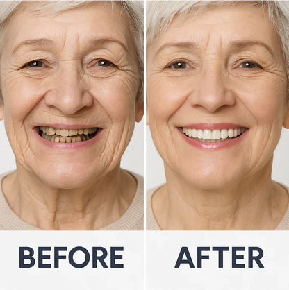 Custom-SET Functional Dentures